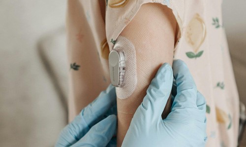 Stick to skin wearable medical device